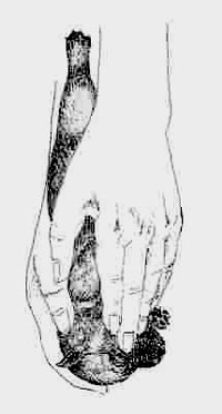 early_neurological_stimulation_en_img_2s